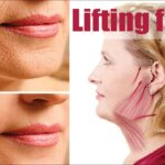 ¿Cómo se hace un lifting facial?